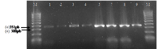 Producto PCR amplificado con los cebadores BLKC-delantero/ BLKC-reverso
del gen de la к-caseína en muestras de hembras bovinas identificadas por los números
(1,2,3,4,5,7,8 y 9). Con la letra M se indica el marcador molecular de 100pb.