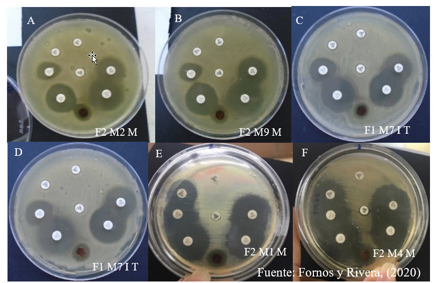 Aislados
de R. solanacearum
con fenotipos AmpC hiperproducido
(A, B, C y D) y fenotipos salvajes (E y F) aislados de las zonas de
muestreo.