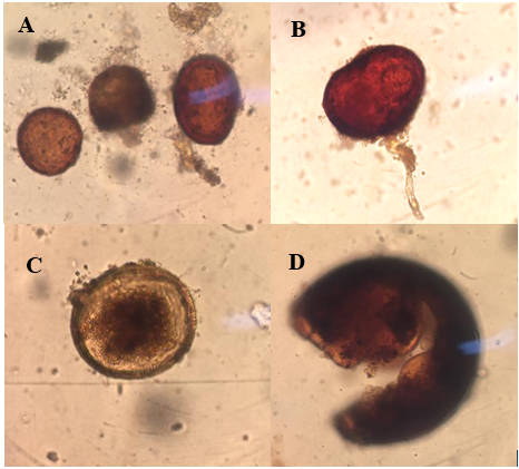 Géneros de HMA
identificados en muestras de suelo procedentes de
fincas
con cultivos de cítrico, Glomus sp (A) Scutellospora sp (B) Acaulospora sp
(C) Septoglomus sp (D).